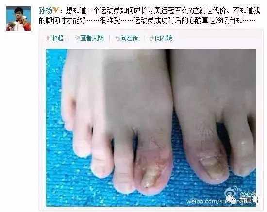 游泳冠军游泳视频_游泳冠军叫什么_儿童游泳冠军是谁