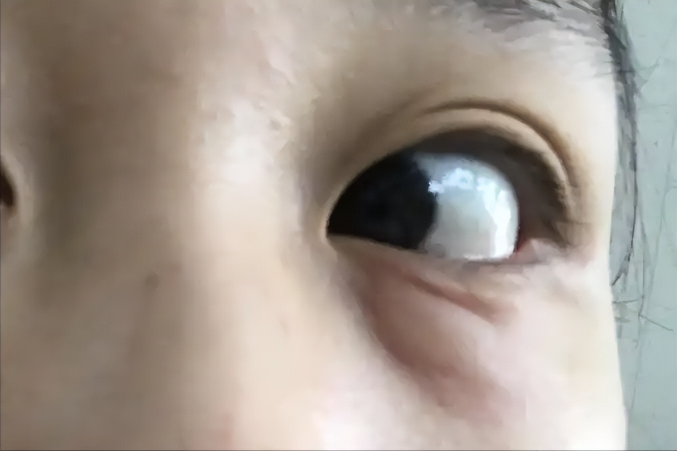 身体脸浮肿_身体健康脸肿_肿脸是什么病