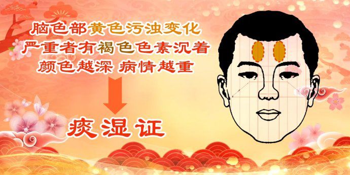身体肿脸肿是什么原因_肿脸是什么意思_身体健康脸肿