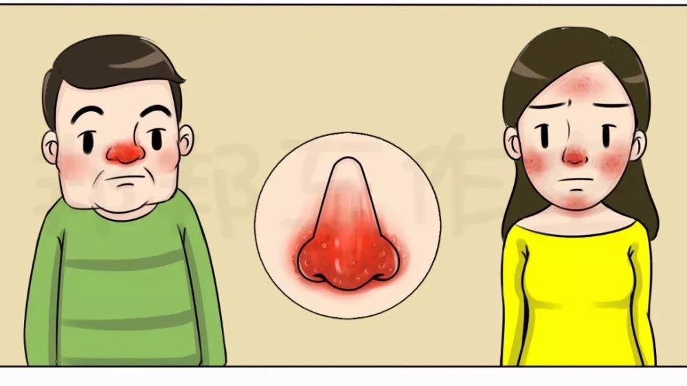 身体健康脸肿_脸肿身体肿是什么病症_肿脸是什么意思